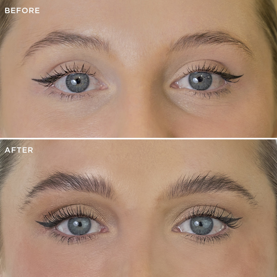 Before and after comparison 2