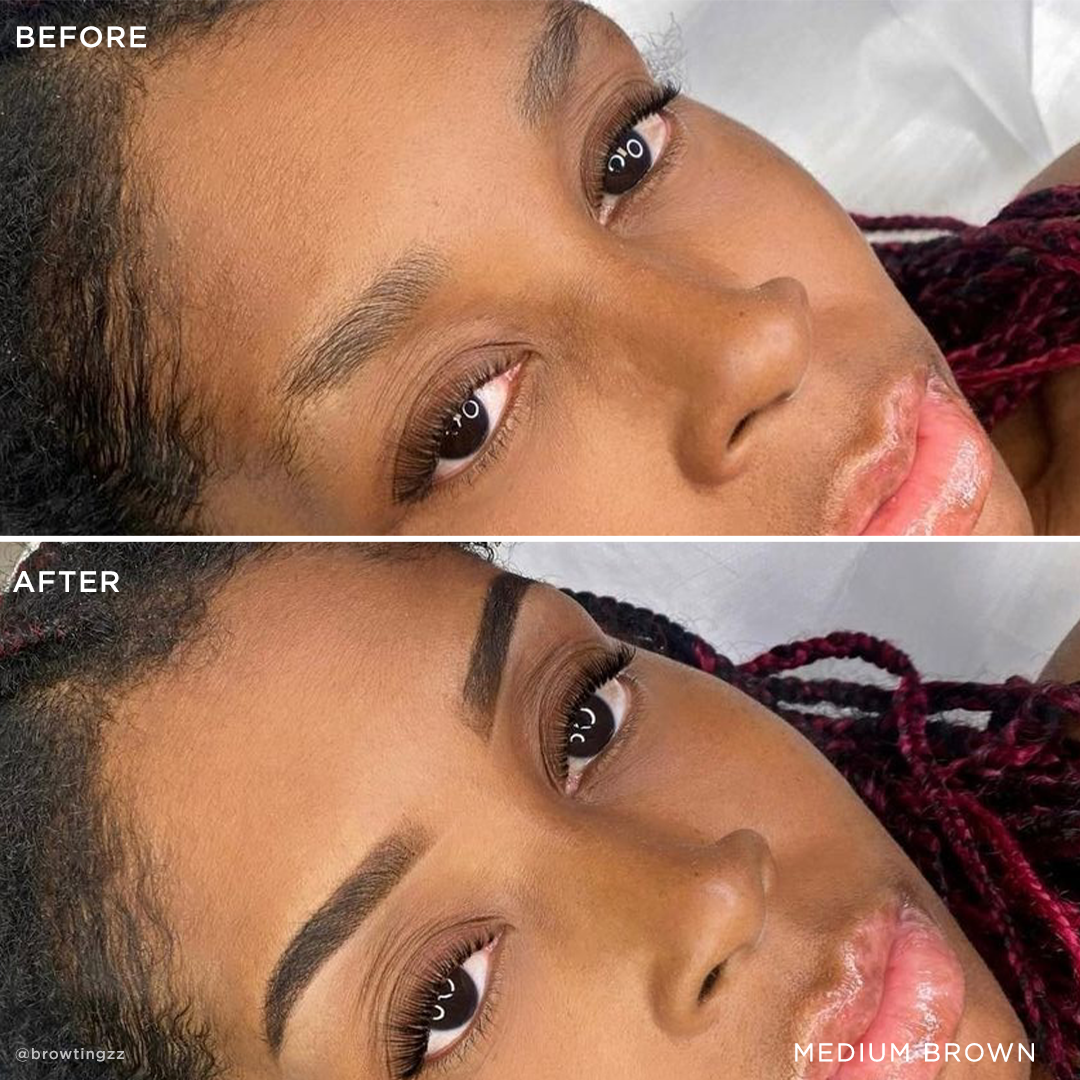 Before and After 2
