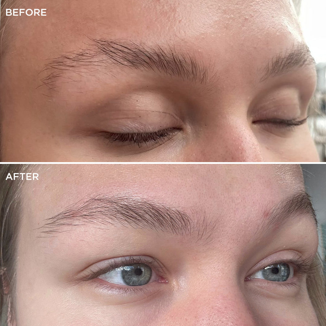 Before and after comparison 5